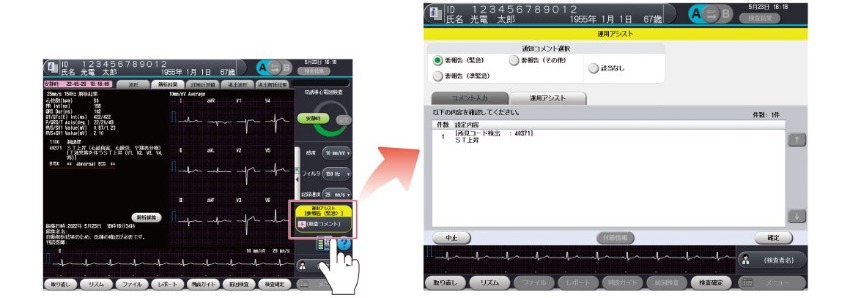 検査時間短縮・ワークフロー効率化を目指して ｜日本光電