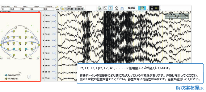 脳波検査の効率化と長時間ビデオ脳波モニタリングの支援 ｜日本光電