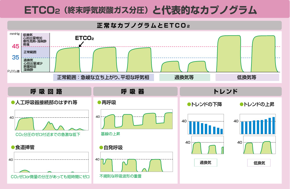 呼吸管理｜日本光電のNICU向け製品｜医療関係の皆様へ｜日本光電