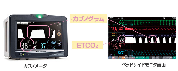 呼吸管理｜日本光電のNICU向け製品｜医療関係の皆様へ｜日本光電