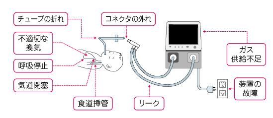 呼吸管理｜日本光電のNICU向け製品｜医療関係の皆様へ｜日本光電