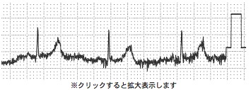 タオル 心電図 トップ