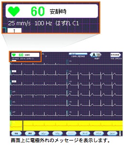 電極装着のポイント：きれいな心電図を記録するポイント ～標準12誘導心電図編～｜正しくお使いいただくために｜医療関係の皆様へ｜日本光電