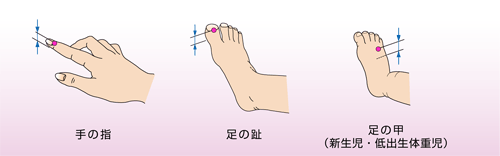 プローブ装着のポイント：SpO2プローブ装着のポイント｜正しくお使いいただくために｜医療関係の皆様へ｜日本光電