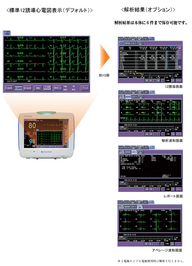 ベッドサイドモニタ BSM-3000シリーズ ライフスコープ VS｜救命救急関連機器｜製品情報｜医療関係の皆様へ｜日本光電