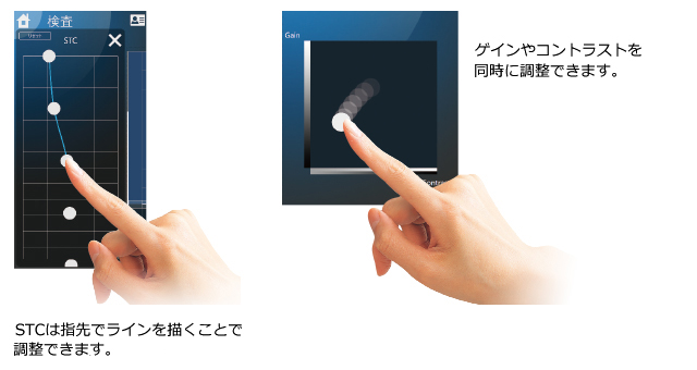 超音波画像診断装置 TUPシリーズ｜在宅医療関連機器｜製品情報