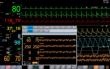 BISx モジュール NK｜ベッドサイドモニタ｜製品情報｜医療関係の皆様へ｜日本光電