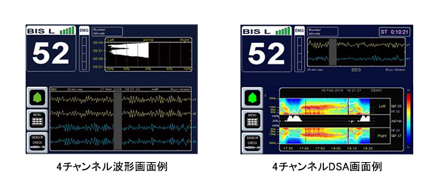 BISモニタリングシステム｜ベッドサイドモニタ｜製品情報｜医療関係の皆様へ｜日本光電