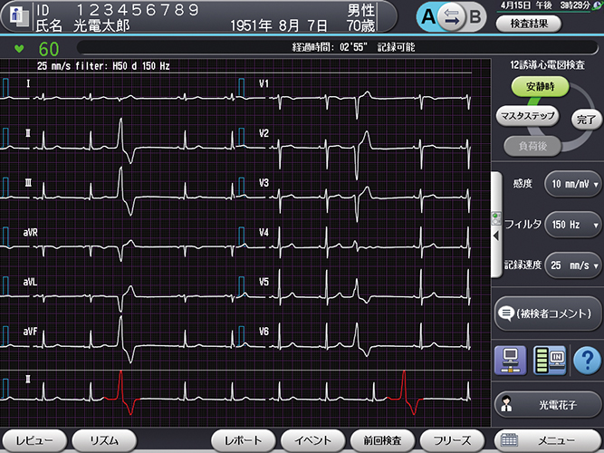 心電計 ECG-2500シリーズ｜心電計｜製品情報｜医療関係の皆様へ｜日本光電