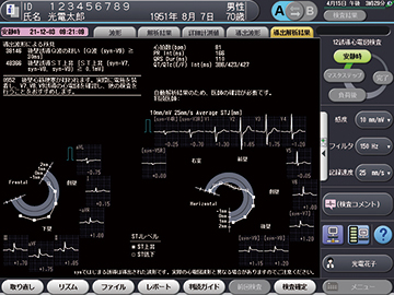 心電計 ECG-2500シリーズ｜心電計｜製品情報｜医療関係の皆様へ｜日本光電