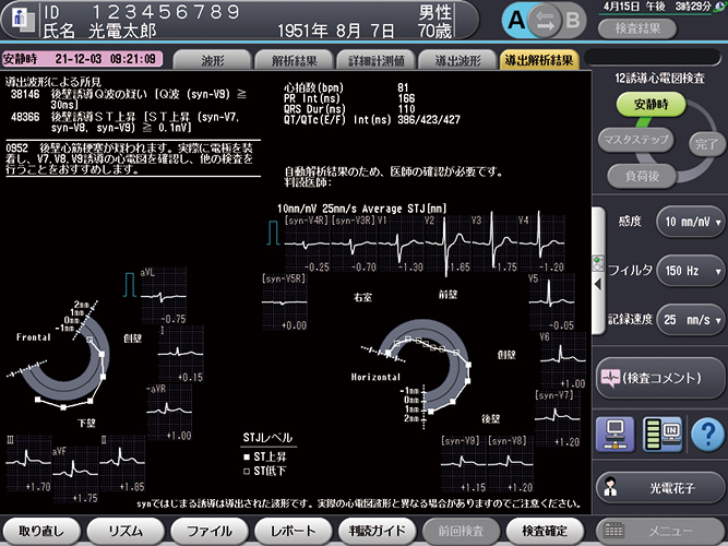 心電計 ECG-2500シリーズ｜心電計｜製品情報｜医療関係の皆様へ｜日本光電