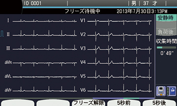 心電計 ECG-2250｜心電計｜製品情報｜医療関係の皆様へ｜日本光電