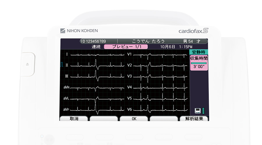 心電計 ECG-3250｜心電計｜製品情報｜医療関係の皆様へ｜日本光電