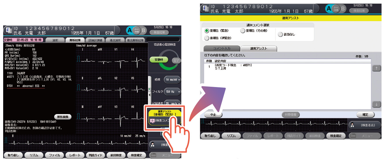 管理機能拡張ソフトウェア｜心電計｜製品情報｜医療関係の皆様へ