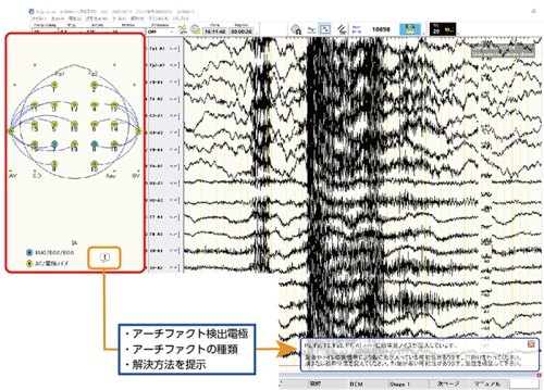 グラフィック神経学 注目研究の紹介 2020年5月 - 国立大学法人 京都工芸繊維大学