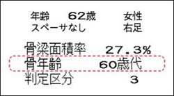 超音波骨量測定装置「ビーナス」｜画像診断機器｜製品情報｜医療関係の皆様へ｜日本光電