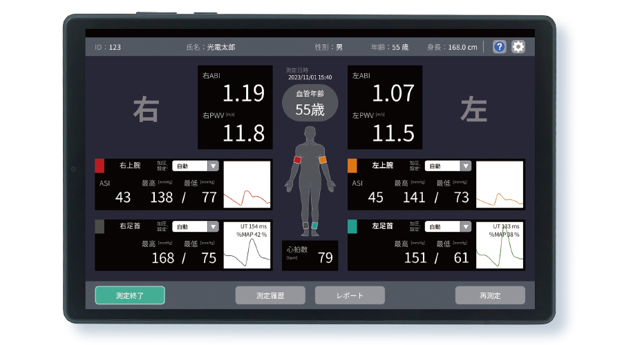 血圧脈波検査装置 ArterioVision MS-3000｜血管機能検査機器｜製品情報｜医療関係の皆様へ｜日本光電