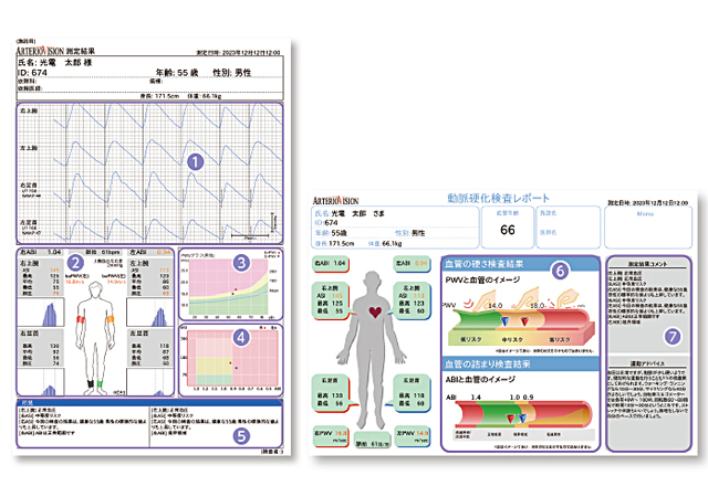 血圧脈波検査装置 ArterioVision MS-3000｜血管機能検査機器｜製品情報｜医療関係の皆様へ｜日本光電