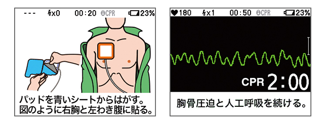 自動体外式除細動器 AED-3100シリーズ カルジオライフ｜除細動器｜製品