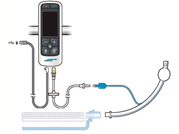 IntelliCuff（インテリカフ）｜人工呼吸器｜製品情報｜医療関係の皆様へ｜日本光電