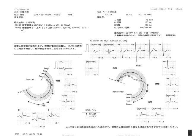 導出18誘導心電図とは：導出18誘導心電図｜技術情報｜医療関係の